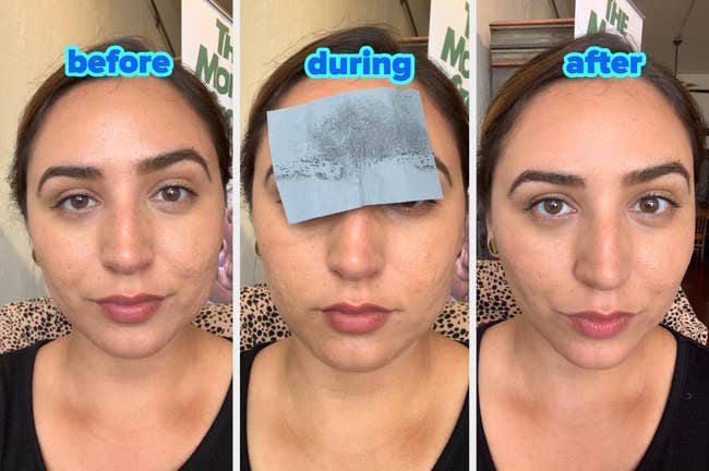 Three-panel examination of a pistillate utilizing oil-absorbing sheets connected her face. Panels labeled
