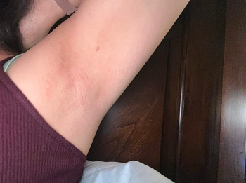 reviewer's underarm after waxing with all hair removed