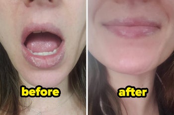 reviewer before and after of chapped lips and healed lips 