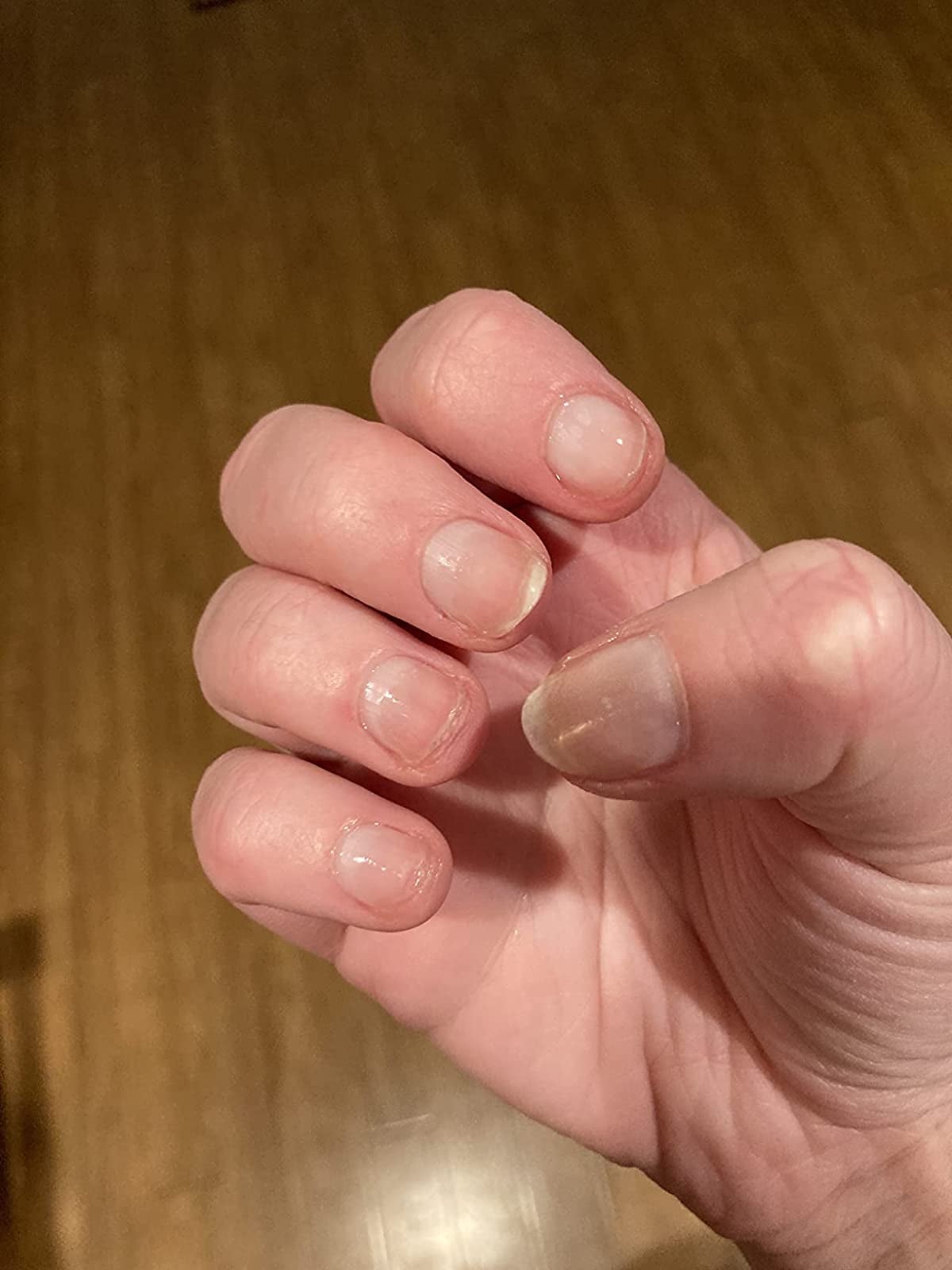 19 Products To Help Stop Nail Biting 19 Products To Help Stop Nail Biting