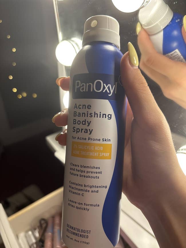 Hand holding a vessel  of PanOxyl Acne Banishing Body Spray, highlighted for its acne attraction    properties and dermatologist recommendation