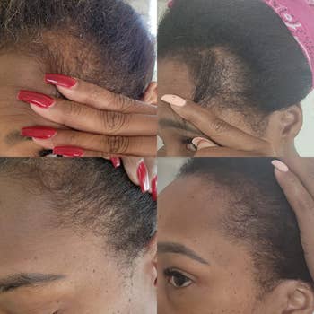 four side by side before and afters of a reviewer's edges growing back in