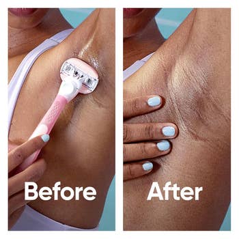 Side-by-side images showing an armpit being shaved and the aforesaid  armpit creaseless  aft  shaving, labeled 