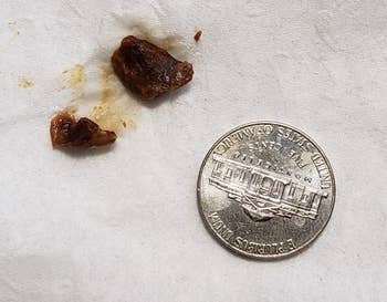 reviewer's two clumps of earwax next to a nickel for size comparison