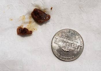 reviewer representation  of 2  clumps of earwax adjacent  to a nickel for size comparison
