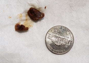 reviewer image of two clumps of earwax next to a nickel for size comparison