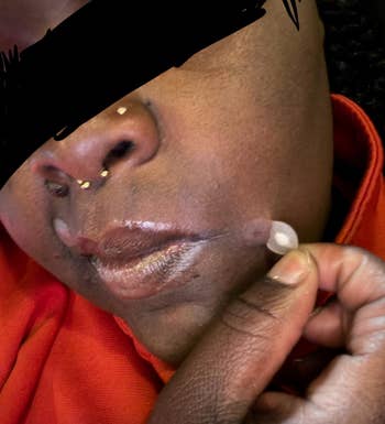 Person applying a small, circular blemish spot  to their cheek