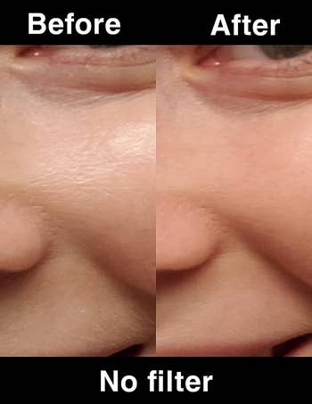 before/after of a face that was oily and looks matte after using the roller