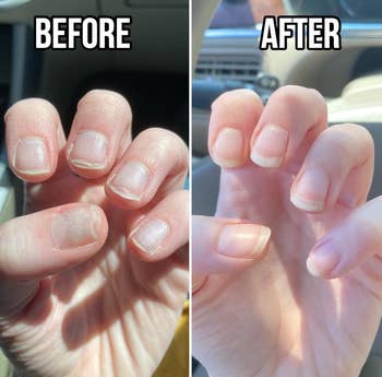 Comparison of reviewers nails before and after using nail cream