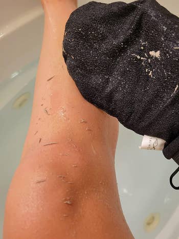 reviewer photo of them revealing dead skin build-up on their leg and on a black exfoliating mitt