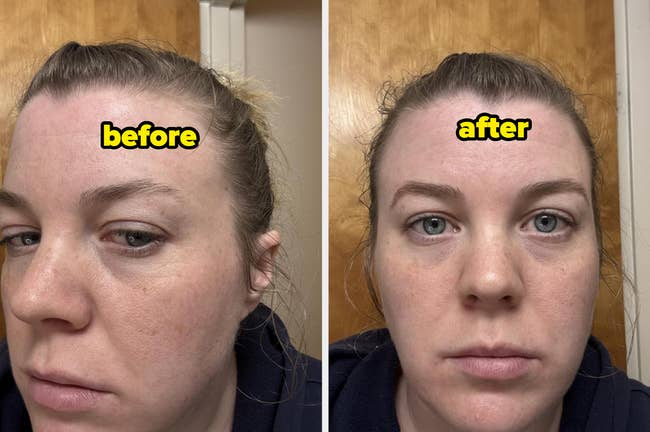Side-by-side photo collage showing a woman's face before and after using a skincare product, highlighting reduced under-eye puffiness