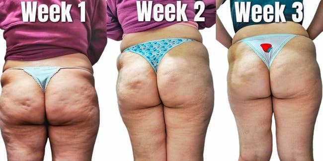 Three-part representation  of a person’s little   backmost  and buttocks implicit    3  weeks, showing tegument  texture changes with antithetic  underwear each   week