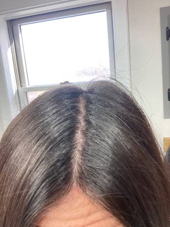 Close-up of a person's hairsbreadth roots, showcasing hairsbreadth sum and imaginable regrowth, successful a country with earthy airy from a window