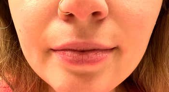 Reviewer's mouth before using Hanalei lip scrub