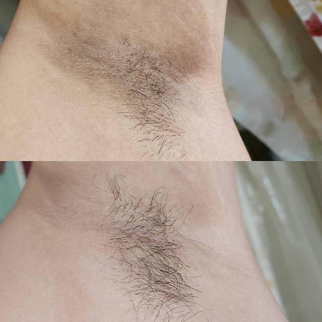 before and after images of a reviewer's dark underarm becoming lighter