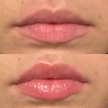 reviewer's before and after showing plumper lips