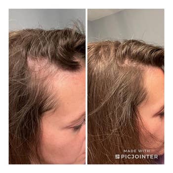 Before and after image of a reviewer's hairline, showing thin/light spots then filled in with the powder