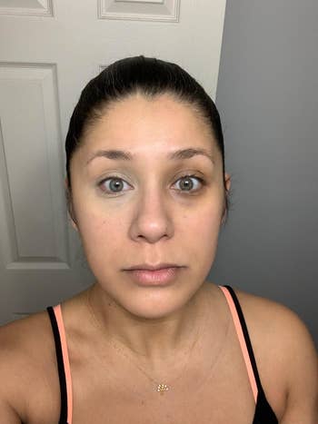 Reviewer with concealer under one eye showing difference