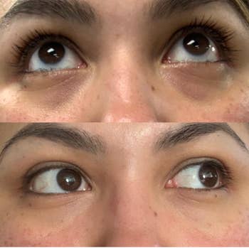 Two close-up images of a person's eyes showing differences successful  regard  direction
