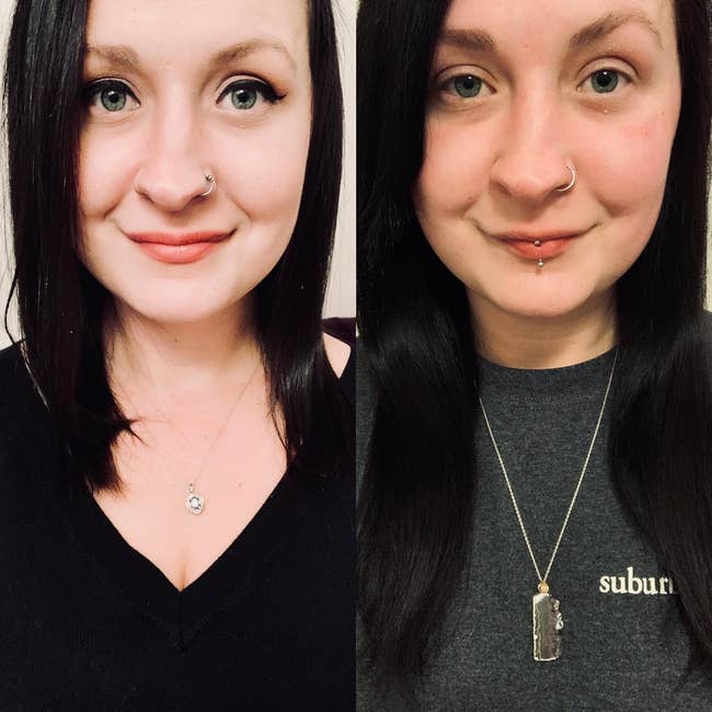 split image of reviewer's hair before using the product and after showing growth
