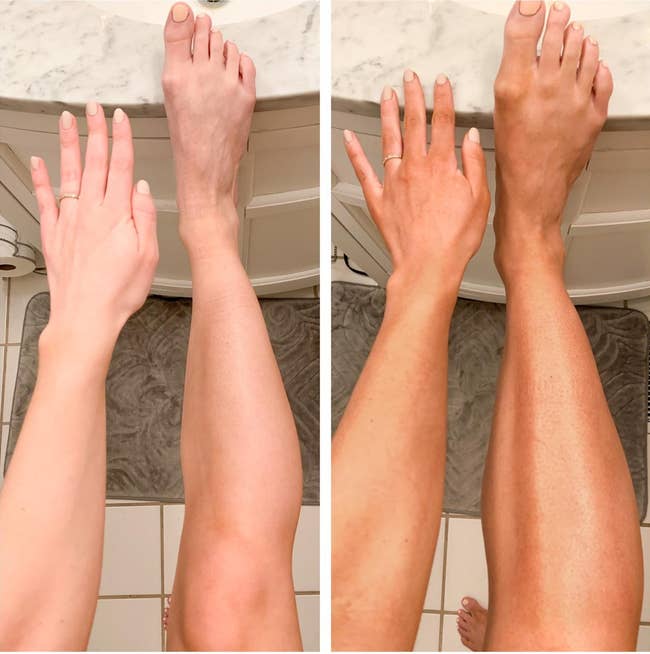before and aft images of a reviewer's airy tegument becoming darker