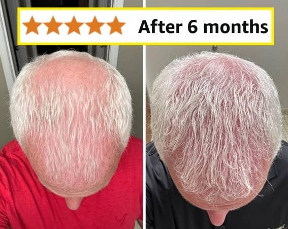 hair before and after six months of use