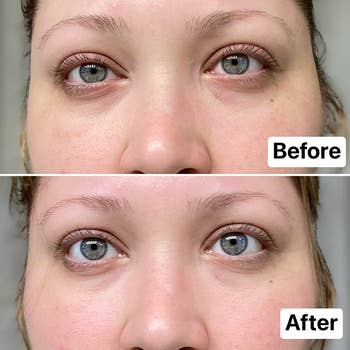 Reviewer with dark circles under eyes,