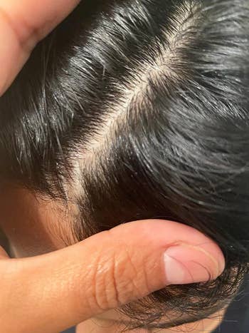 Reviewer's child's head clear of dandruff