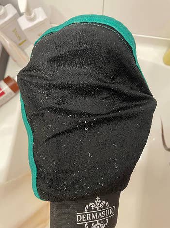 reviewer's exfoliating mitt with dead skin on it