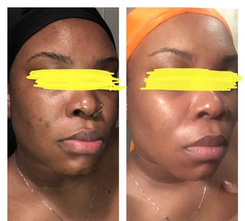 a split reviewer image of their face before and after using the cleanser