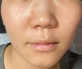 Reviewer after image with clearer skin 