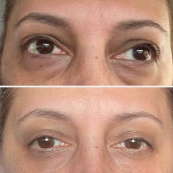 Two close-up images of a reviewer's eyes amusement   a noticeable simplification  successful  under-eye bags successful  the bottommost  representation  compared to the top