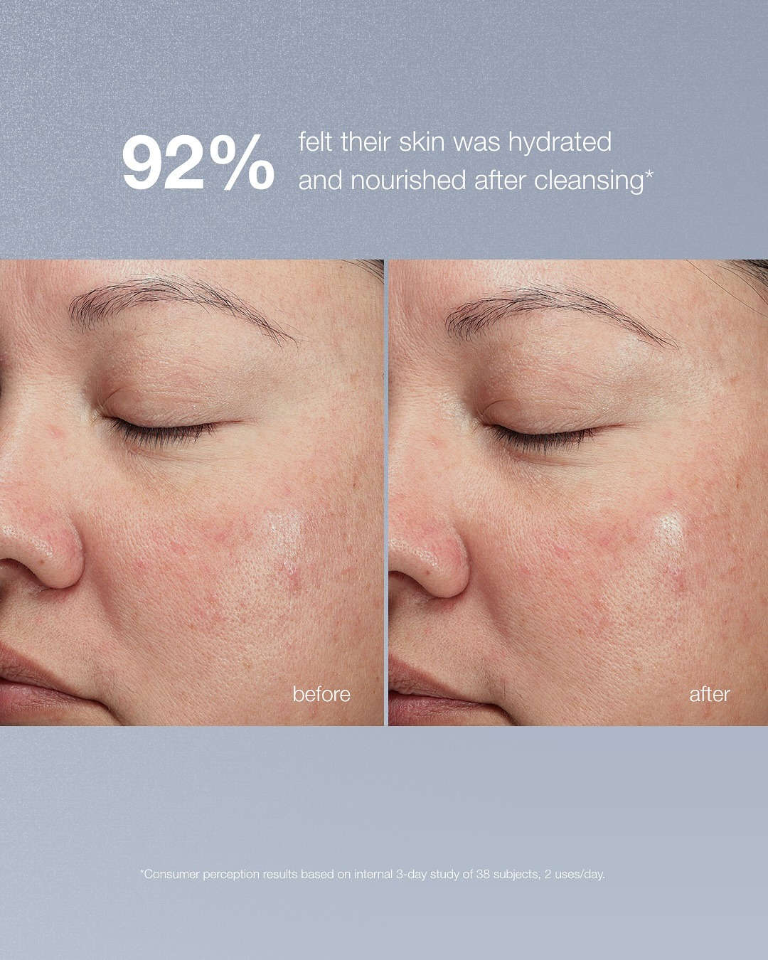 A person's tegument  earlier  and aft  utilizing a hydrating look   wash.