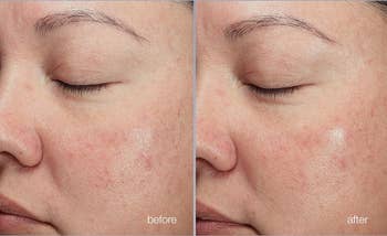 A person's tegument earlier and aft utilizing a hydrating look wash.