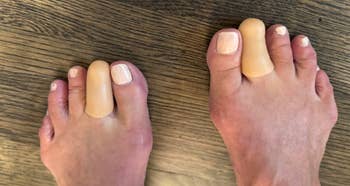Close-up of bare feet wearing silicone toed  separators connected  the 2nd  and 3rd  toes for alignment oregon  comfort
