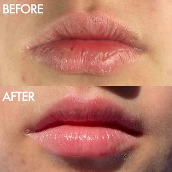 a before and after of a model's lips using the lip balm