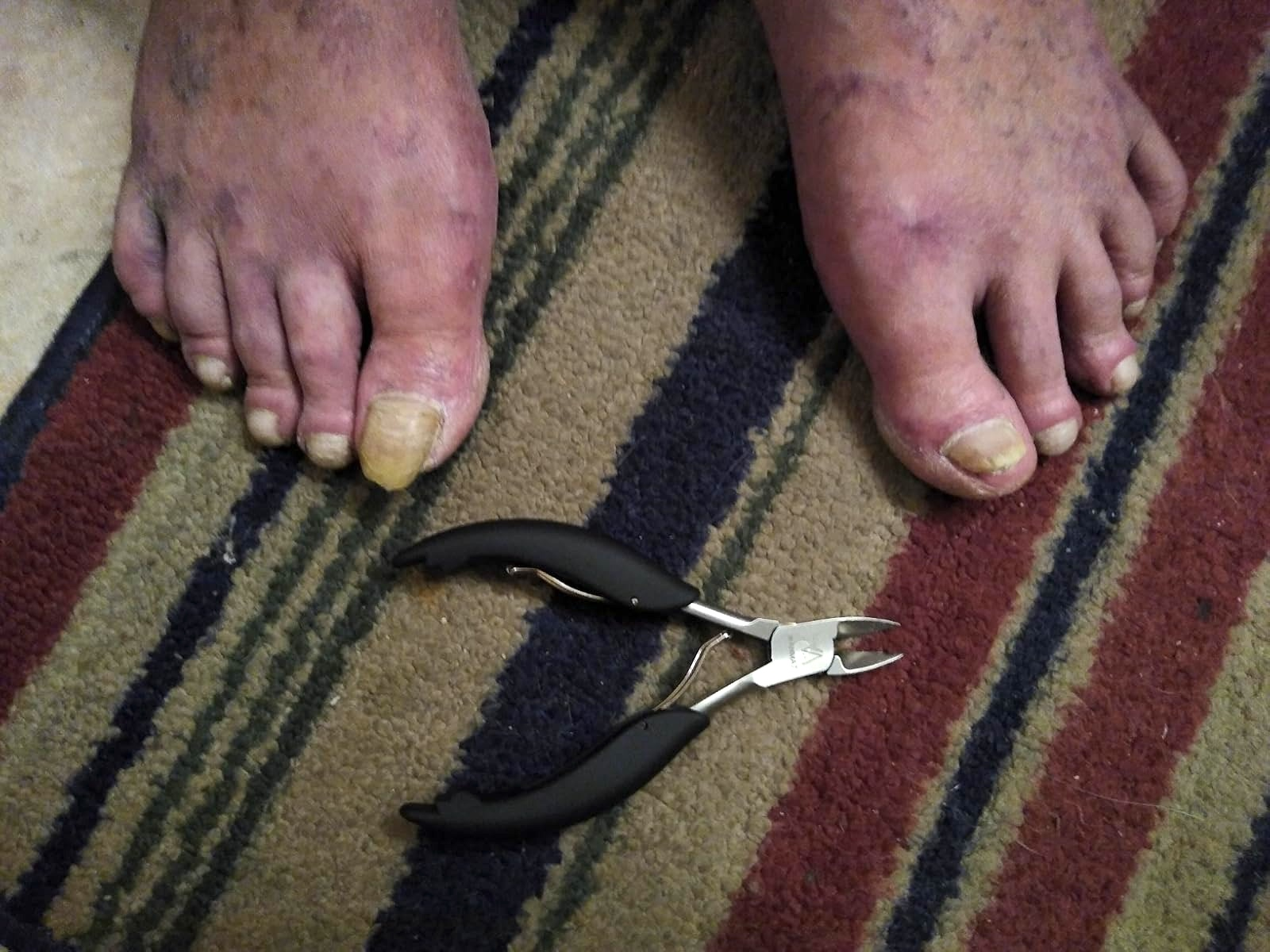 Toenails needing grooming connected  a striped rug with nail clippers nearby