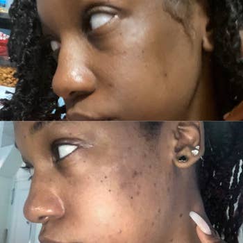 Before and after image of reviewer with evened out skin tone 