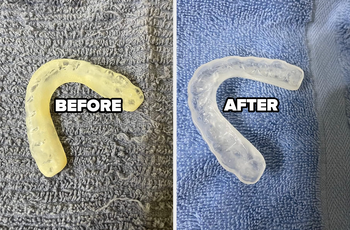 a reviewer's night guard before stained yellow and after looking almost new