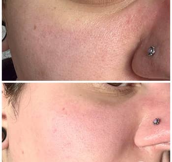 A reviewer with larger, more noticeable nose pores in one photo and with cleaner, more diminished pores in the second photo