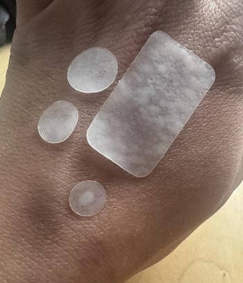 Transparent adhesive patches successful  assorted  shapes connected  a hand's surface