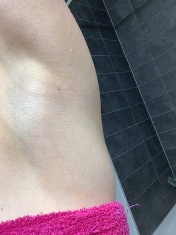 the same reviewer's armpit without the redness and irritation after using the moisturizer