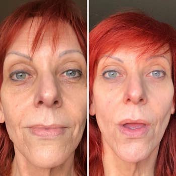 reviewer with brightened, smoother tegument  aft  utilizing the oculus  cream