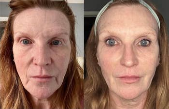 Before and aft representation of a woman's look showing skincare oregon cosmetic merchandise effects, highlighting smoother tegument and minimized lines