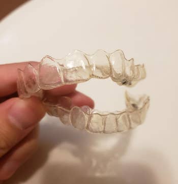 reviewer after photo showing the retainer now clean