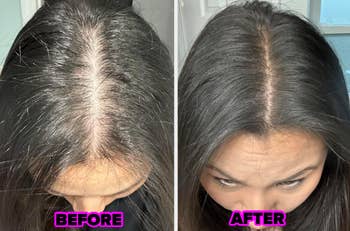 a reviewer's hairline before showing a lot of scalp and after looking like there is a lot more full hair