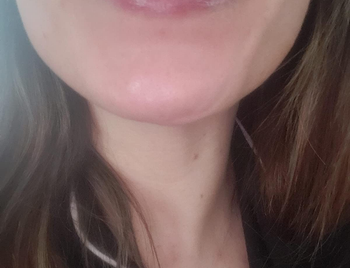 same reviewer's lips looking soft and moisturized after applying the balm