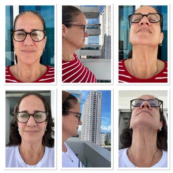 Reviewer before and after using neck cream
