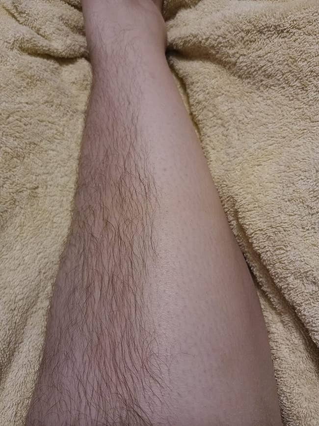 reviewer photo of a leg, half of which is hairy and the other half of which is totally smooth