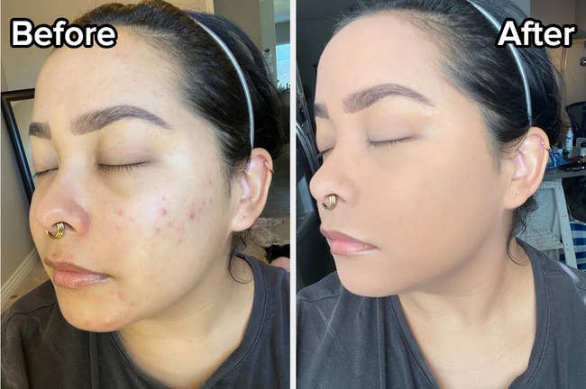 reviewer before and after of their skin without and then with the foundation 